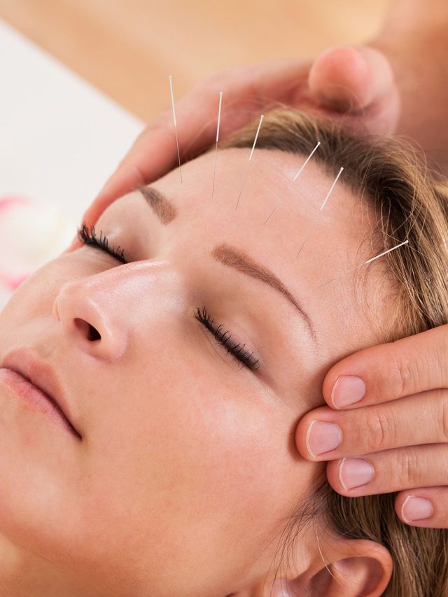 Acupuncture Treatment On Insomnia And Proper Management