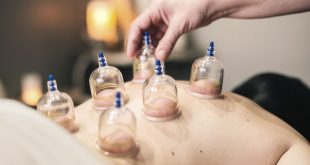 cupping Therapy